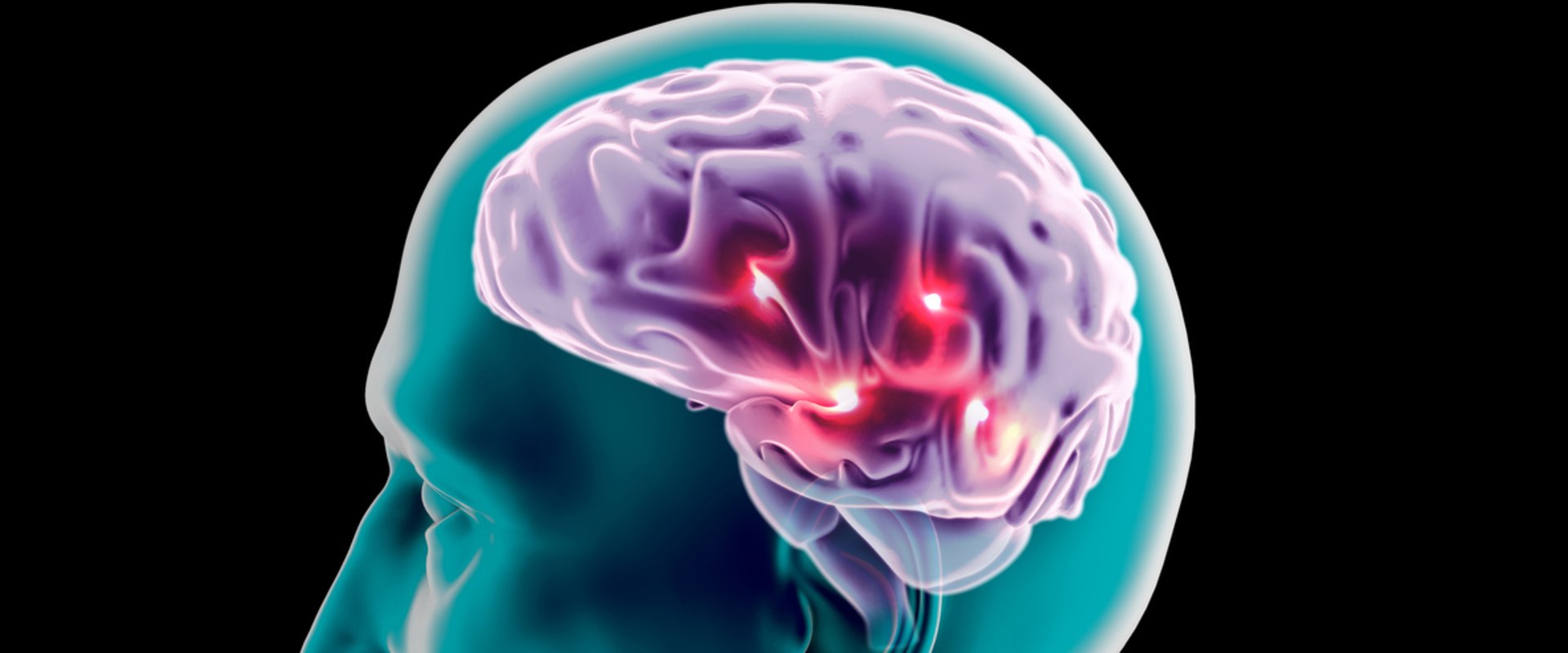 The Brain Behind Addiction: How the Prefrontal Cortex and Midbrain are Affected